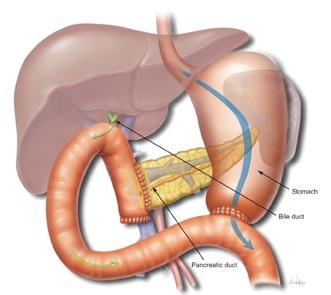 Traumatism pancreatic